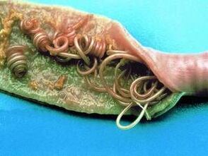 As causas dos parasitos no corpo humano