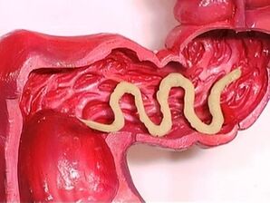 parásitos no corpo humano por que aparecen