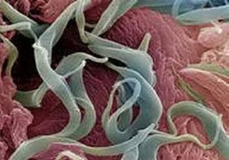 Síntomas e tratamento de parasitos no corpo humano